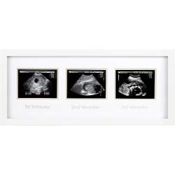 marco ecografia trimestral regalos originales embarazadas
